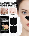 Nose Black Head Remover Strips