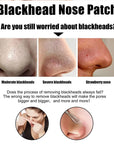 Nose Black Head Remover Strips