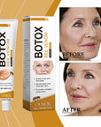 Botox Bee Venom Wrinkle Removal Cream