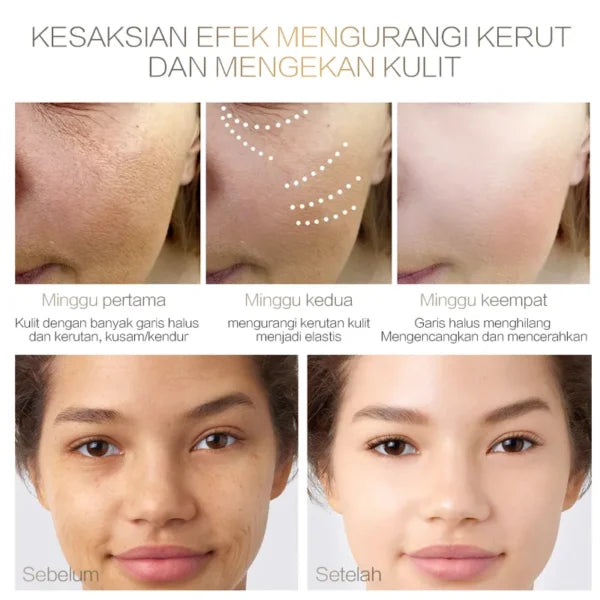 Chalonese Brightening Cream