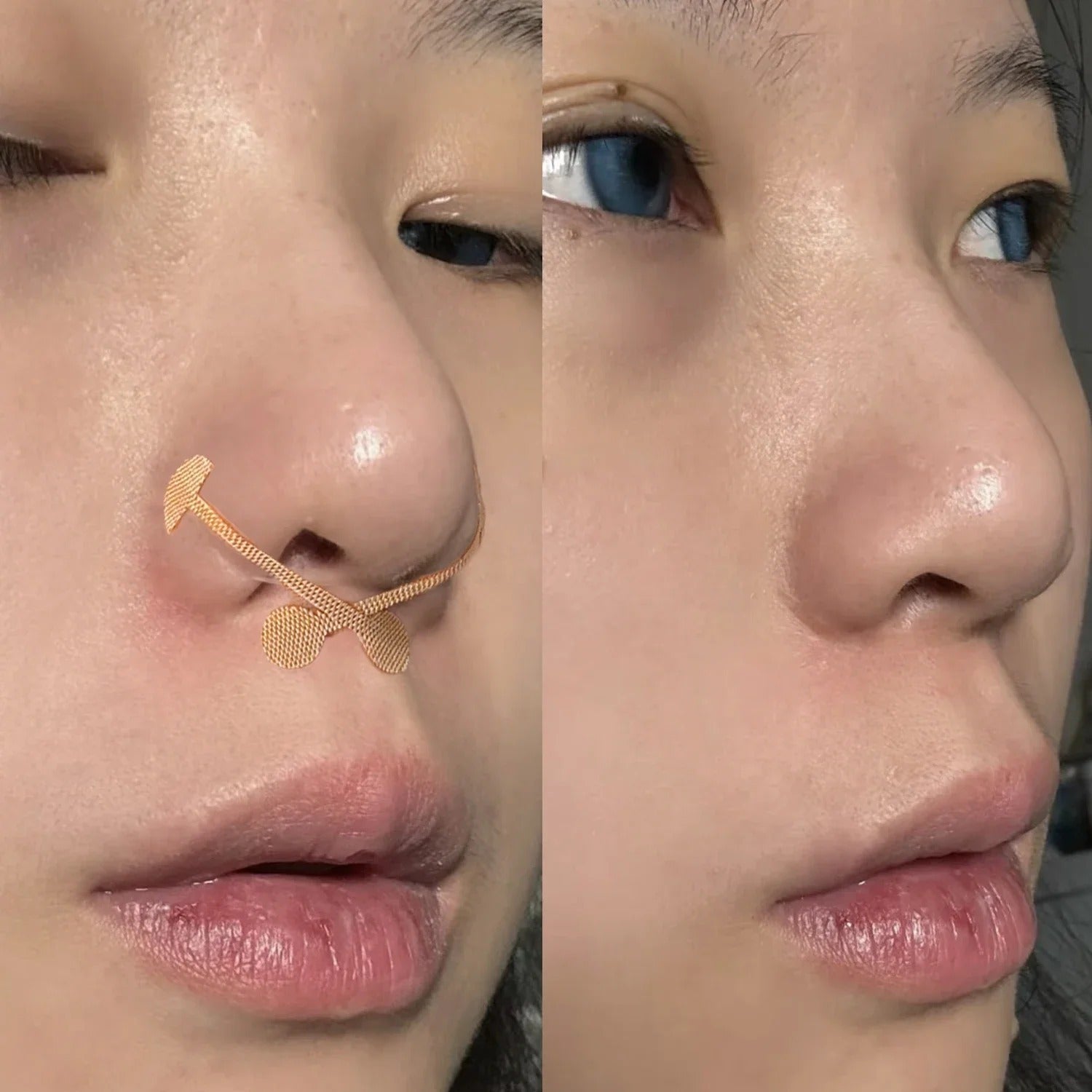 Dumbbell Nose Tip Patch Contouring Corrective Nose Patch