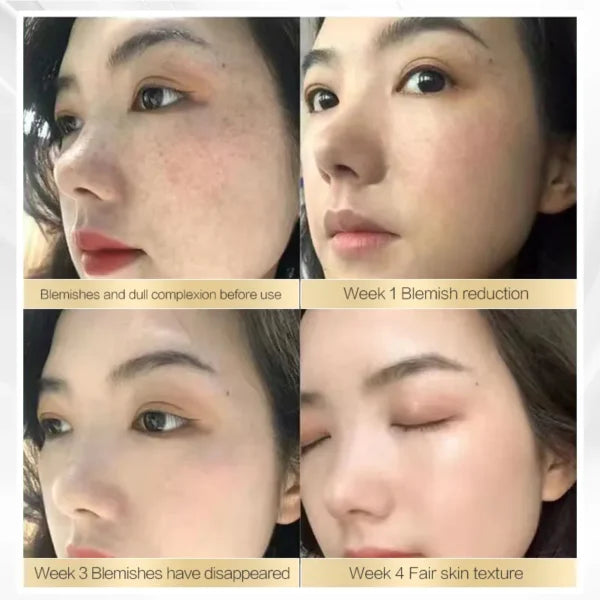 Chalonese Brightening Cream