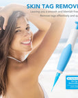 MicroCare Skin Solution - Advanced Skin Tag, Wart, Acne, and Pimple Removal Kit