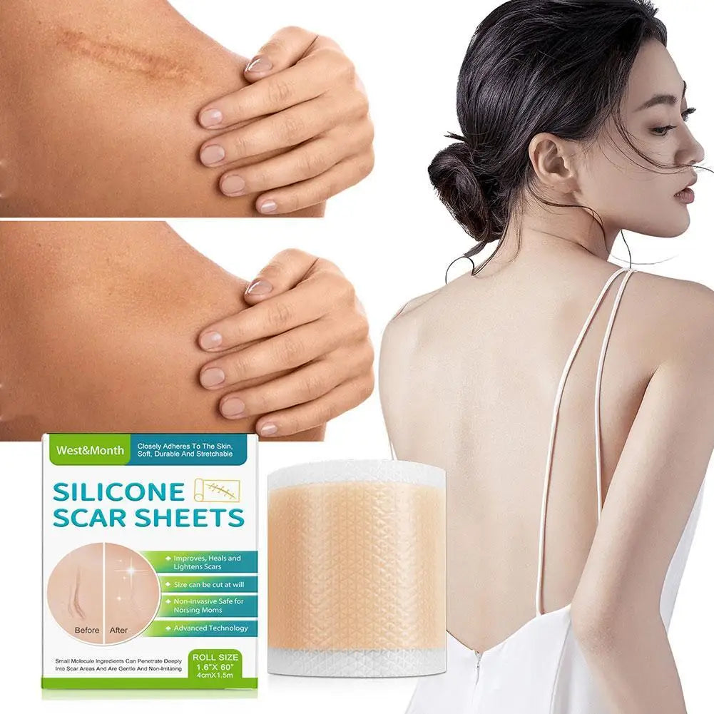 Silicone Scar Medical Skin Care &amp; Pimples Removel Tape