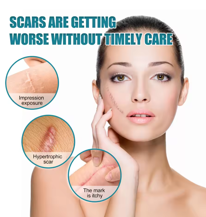 Silicone Scar Medical Skin Care &amp; Pimples Removel Tape