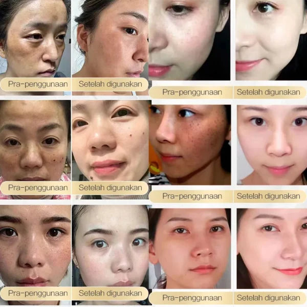 Chalonese Brightening Cream