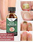 Nail Fungus Treatment Serum 10ml