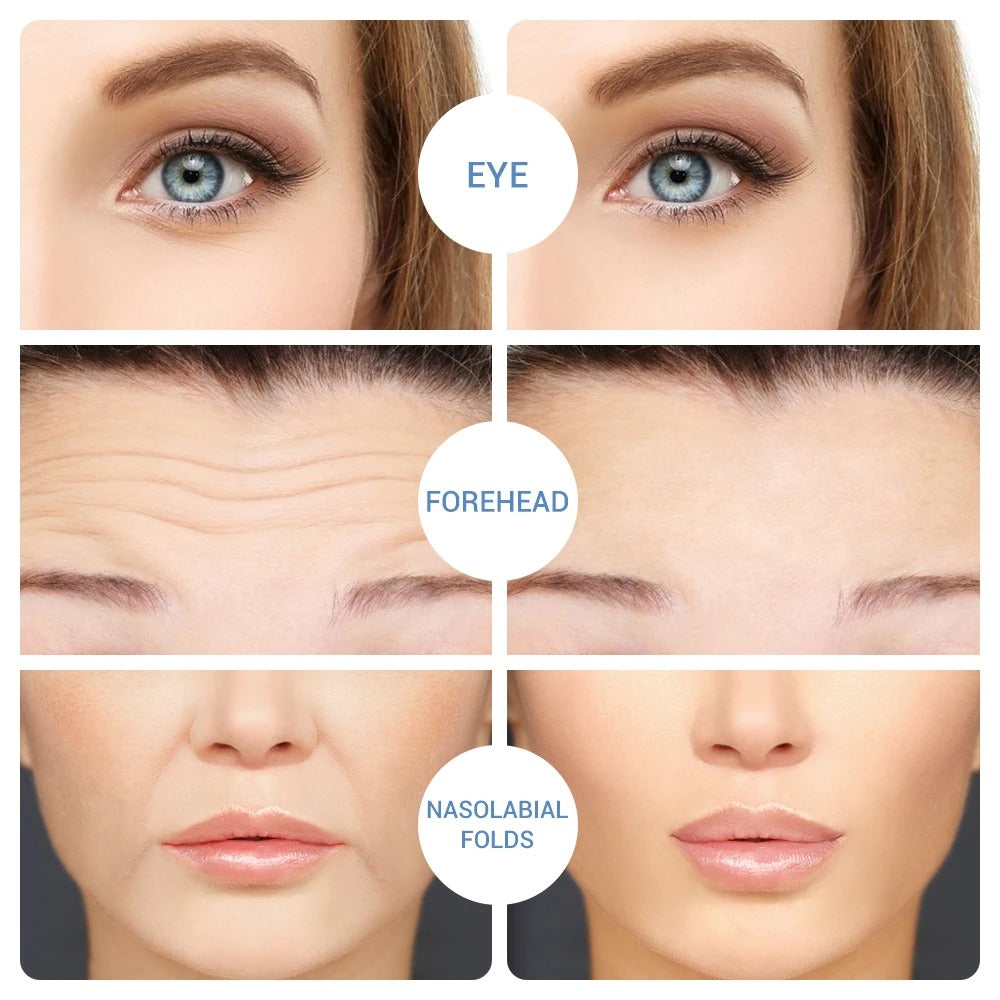 Hyaluronic Acid Microneedle Eye Patches(PAIR)